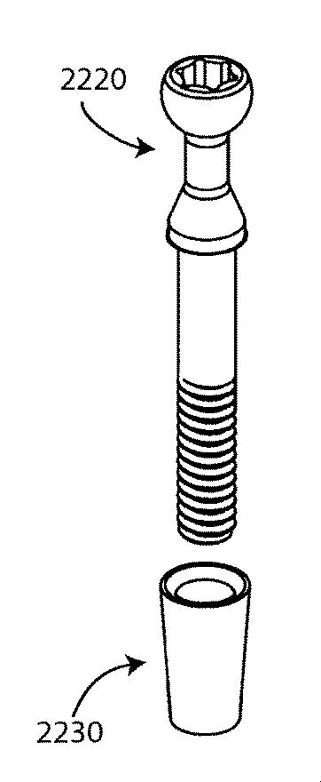 5892446-二重束ＡＣＬ修復システム 図000084