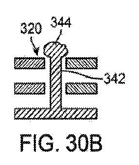 6010545-僧帽弁の修復および置換のためのシステム 図000084