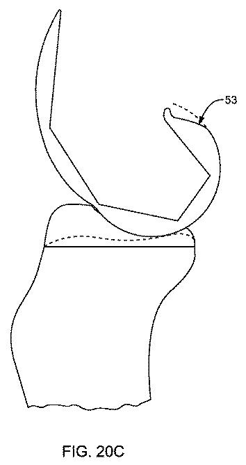 5837876-人工膝患者に深膝屈曲能力を提供するシステム及び方法 図000085