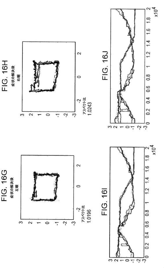 6676522-対象における眼球運動を追跡するためのデバイスの作動方法、および当該デバイスによって追跡された眼球運動のデータの中枢神経系病変を位置特定するための使用方法 図000085