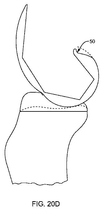 5837876-人工膝患者に深膝屈曲能力を提供するシステム及び方法 図000086