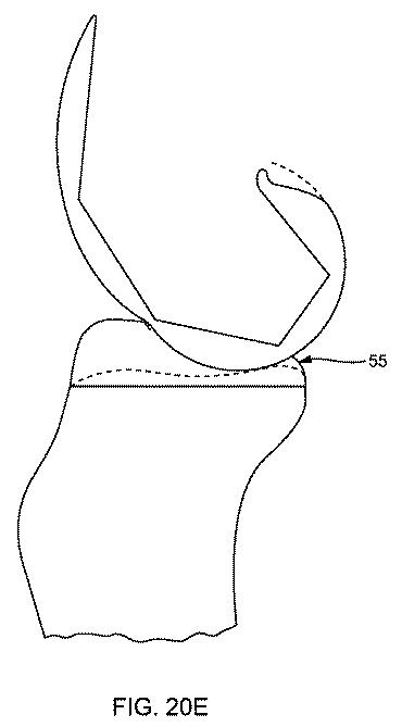 5837876-人工膝患者に深膝屈曲能力を提供するシステム及び方法 図000087