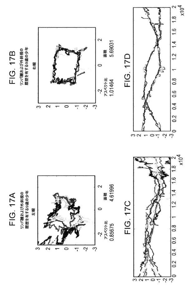 6676522-対象における眼球運動を追跡するためのデバイスの作動方法、および当該デバイスによって追跡された眼球運動のデータの中枢神経系病変を位置特定するための使用方法 図000087