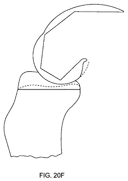 5837876-人工膝患者に深膝屈曲能力を提供するシステム及び方法 図000088