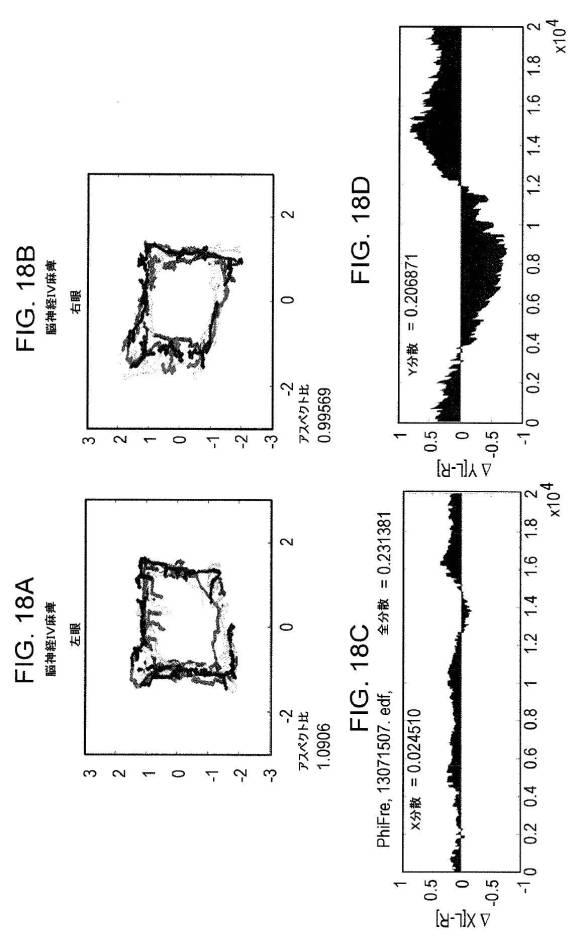 6676522-対象における眼球運動を追跡するためのデバイスの作動方法、および当該デバイスによって追跡された眼球運動のデータの中枢神経系病変を位置特定するための使用方法 図000089