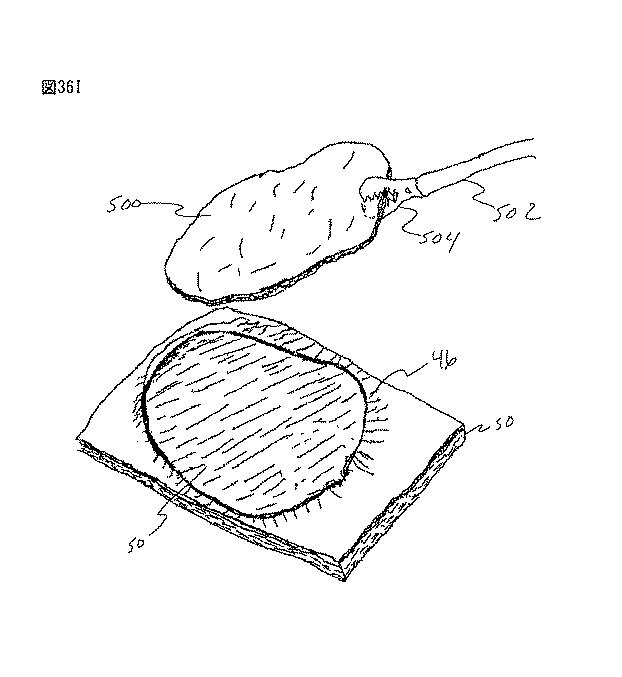 6235672-粘膜下医療処置を実行するための方法及びシステム 図000090