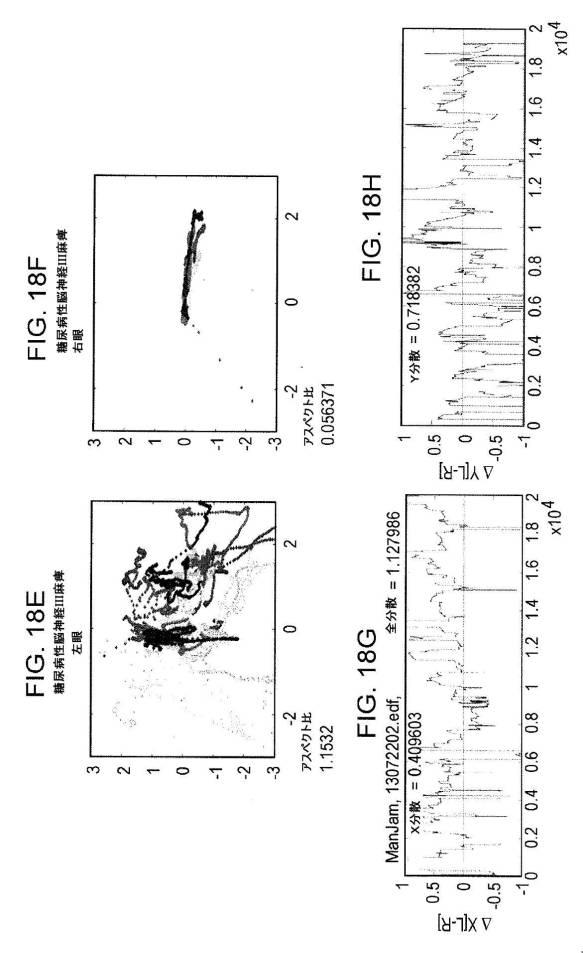 6676522-対象における眼球運動を追跡するためのデバイスの作動方法、および当該デバイスによって追跡された眼球運動のデータの中枢神経系病変を位置特定するための使用方法 図000090