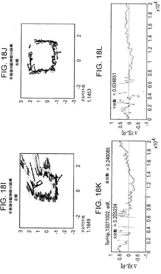 6676522-対象における眼球運動を追跡するためのデバイスの作動方法、および当該デバイスによって追跡された眼球運動のデータの中枢神経系病変を位置特定するための使用方法 図000091