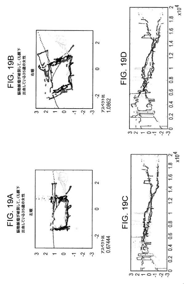 6676522-対象における眼球運動を追跡するためのデバイスの作動方法、および当該デバイスによって追跡された眼球運動のデータの中枢神経系病変を位置特定するための使用方法 図000092