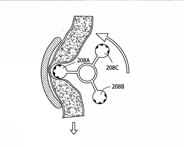 5830513-卵管内の精子の流れを制御する装置 図000093