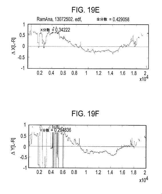 6676522-対象における眼球運動を追跡するためのデバイスの作動方法、および当該デバイスによって追跡された眼球運動のデータの中枢神経系病変を位置特定するための使用方法 図000093