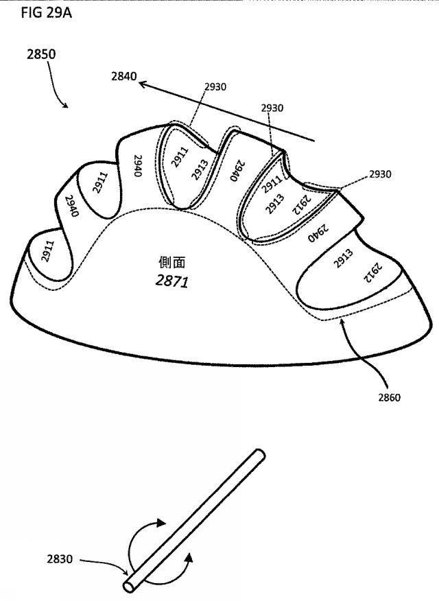 6580038-軟組織切開するための方法及び装置 図000094