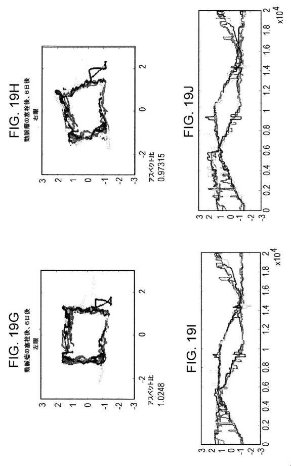 6676522-対象における眼球運動を追跡するためのデバイスの作動方法、および当該デバイスによって追跡された眼球運動のデータの中枢神経系病変を位置特定するための使用方法 図000094