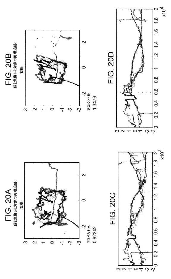 6676522-対象における眼球運動を追跡するためのデバイスの作動方法、および当該デバイスによって追跡された眼球運動のデータの中枢神経系病変を位置特定するための使用方法 図000096