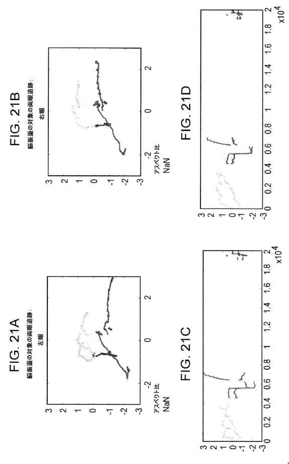6676522-対象における眼球運動を追跡するためのデバイスの作動方法、および当該デバイスによって追跡された眼球運動のデータの中枢神経系病変を位置特定するための使用方法 図000098
