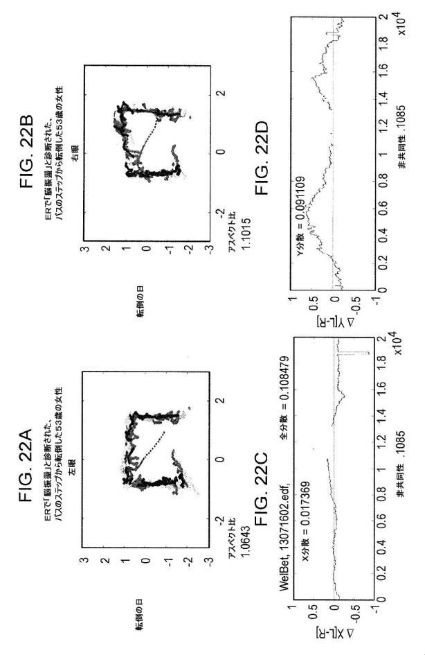 6676522-対象における眼球運動を追跡するためのデバイスの作動方法、および当該デバイスによって追跡された眼球運動のデータの中枢神経系病変を位置特定するための使用方法 図000100