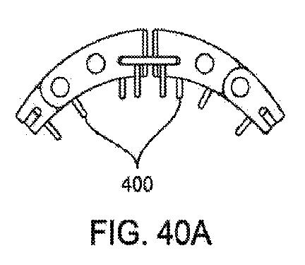 6010545-僧帽弁の修復および置換のためのシステム 図000101