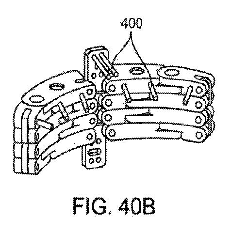 6010545-僧帽弁の修復および置換のためのシステム 図000102