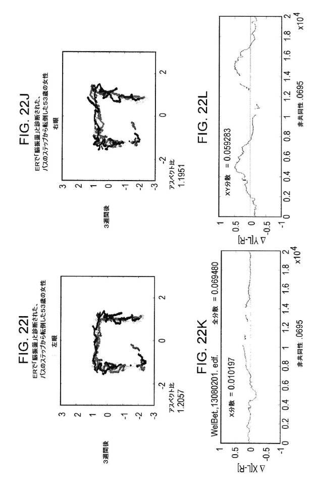 6676522-対象における眼球運動を追跡するためのデバイスの作動方法、および当該デバイスによって追跡された眼球運動のデータの中枢神経系病変を位置特定するための使用方法 図000102