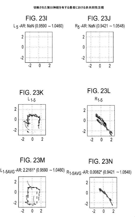 6676522-対象における眼球運動を追跡するためのデバイスの作動方法、および当該デバイスによって追跡された眼球運動のデータの中枢神経系病変を位置特定するための使用方法 図000104