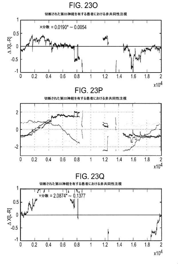 6676522-対象における眼球運動を追跡するためのデバイスの作動方法、および当該デバイスによって追跡された眼球運動のデータの中枢神経系病変を位置特定するための使用方法 図000105