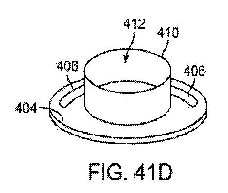 6010545-僧帽弁の修復および置換のためのシステム 図000106