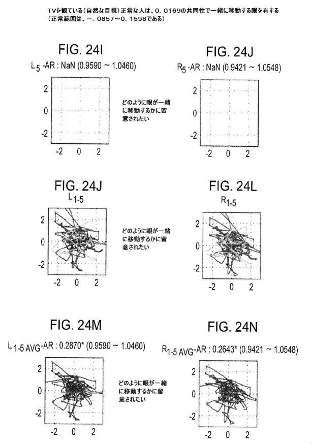 6676522-対象における眼球運動を追跡するためのデバイスの作動方法、および当該デバイスによって追跡された眼球運動のデータの中枢神経系病変を位置特定するための使用方法 図000107