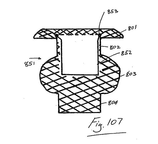 6853312-内腔プロテーゼおよび胃腸インプラントデバイス 図000107