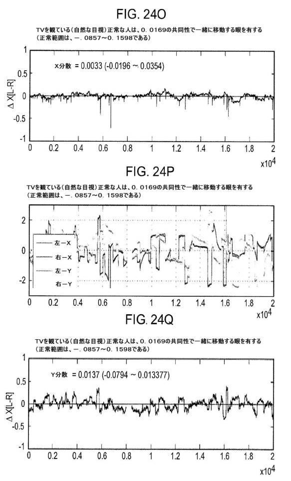 6676522-対象における眼球運動を追跡するためのデバイスの作動方法、および当該デバイスによって追跡された眼球運動のデータの中枢神経系病変を位置特定するための使用方法 図000108