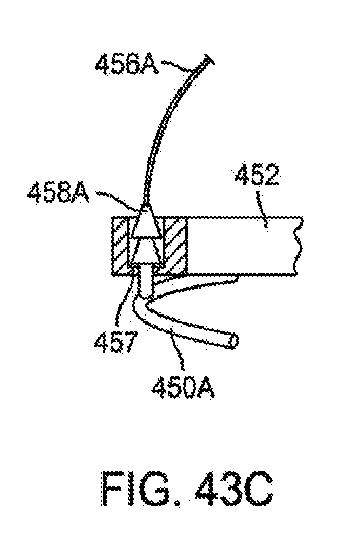 6010545-僧帽弁の修復および置換のためのシステム 図000111