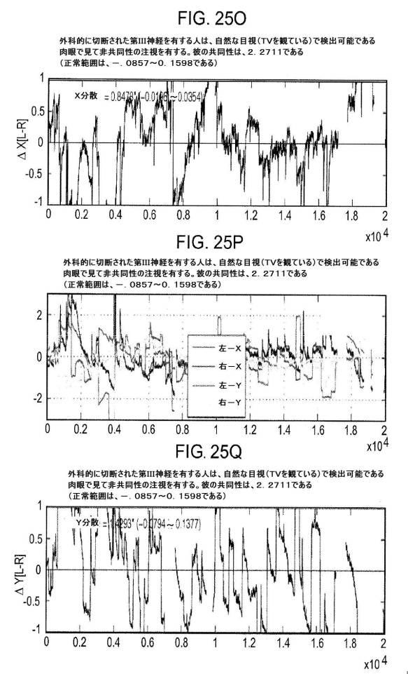 6676522-対象における眼球運動を追跡するためのデバイスの作動方法、および当該デバイスによって追跡された眼球運動のデータの中枢神経系病変を位置特定するための使用方法 図000111