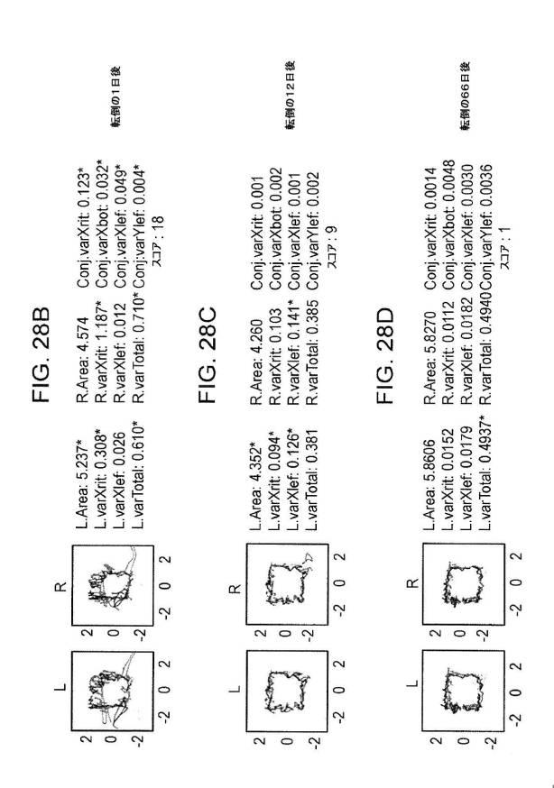 6676522-対象における眼球運動を追跡するためのデバイスの作動方法、および当該デバイスによって追跡された眼球運動のデータの中枢神経系病変を位置特定するための使用方法 図000117