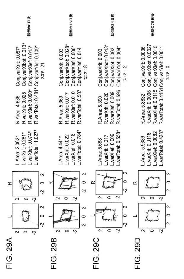 6676522-対象における眼球運動を追跡するためのデバイスの作動方法、および当該デバイスによって追跡された眼球運動のデータの中枢神経系病変を位置特定するための使用方法 図000118