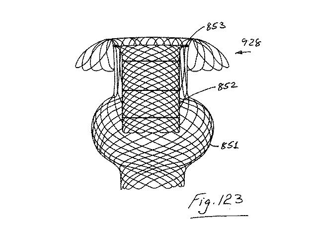 6853312-内腔プロテーゼおよび胃腸インプラントデバイス 図000123