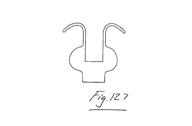 6853312-内腔プロテーゼおよび胃腸インプラントデバイス 図000127