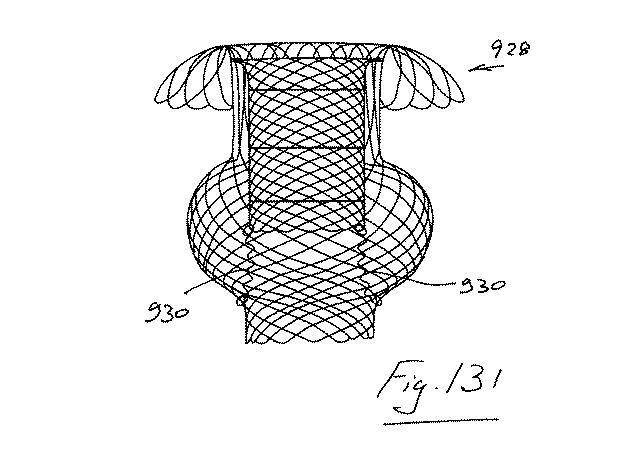 6853312-内腔プロテーゼおよび胃腸インプラントデバイス 図000131