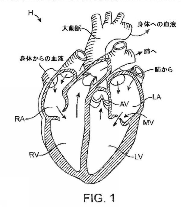 5872692-人工治療装置 図000134