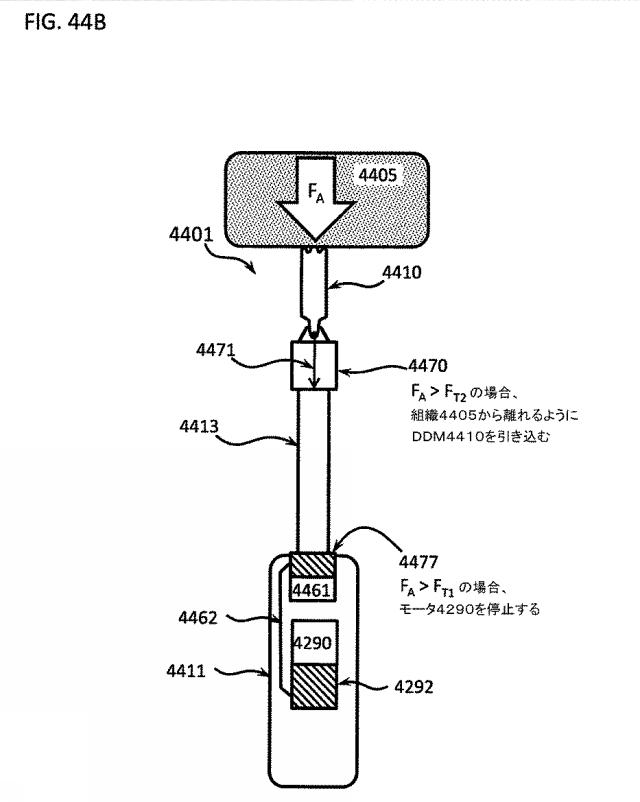 6580038-軟組織切開するための方法及び装置 図000140