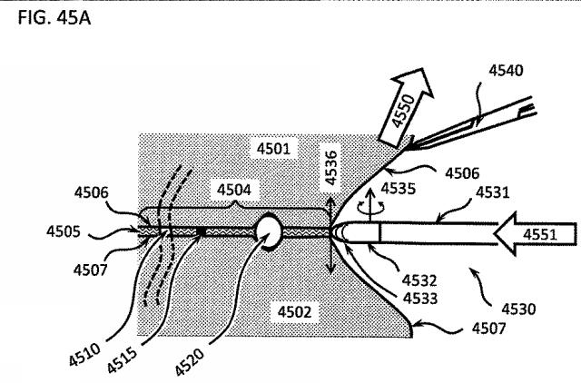 6580038-軟組織切開するための方法及び装置 図000143