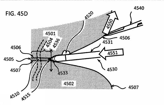 6580038-軟組織切開するための方法及び装置 図000146