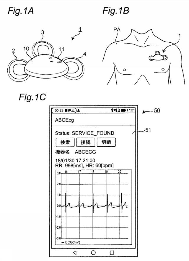 WO2020008864-心電計測システムおよび心電送信機 図000003