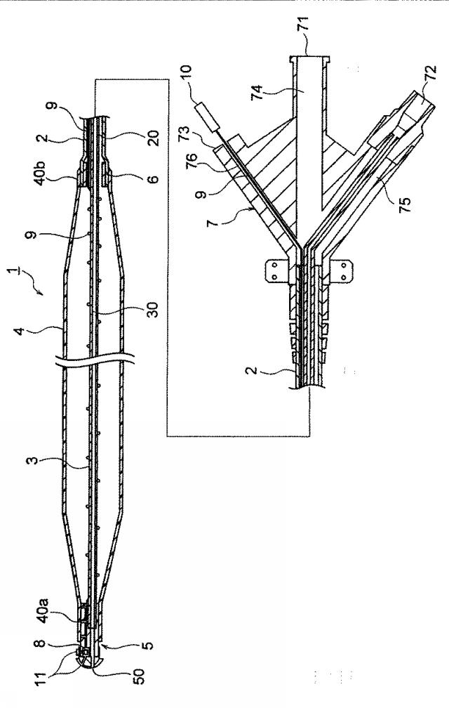 WO2020158572-大動脈内バルーンカテーテル 図000003