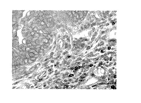 WO2018211936-ＣＣＲ４阻害による制御性Ｔ細胞浸潤抑制法およびイヌの腫瘍性疾患の治療法 図000006