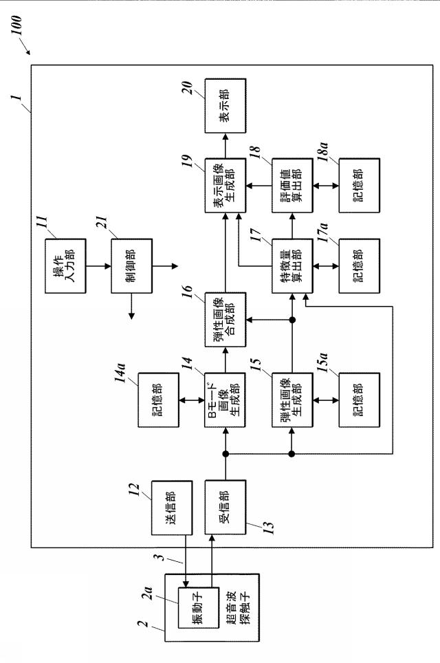 WO2017150355-超音波診断装置及び超音波情報処理方法 図000007