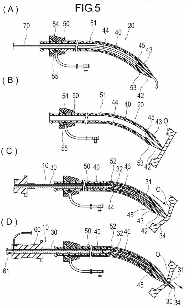 WO2018163899-穿刺デバイス、医療デバイスおよび処置方法 図000008