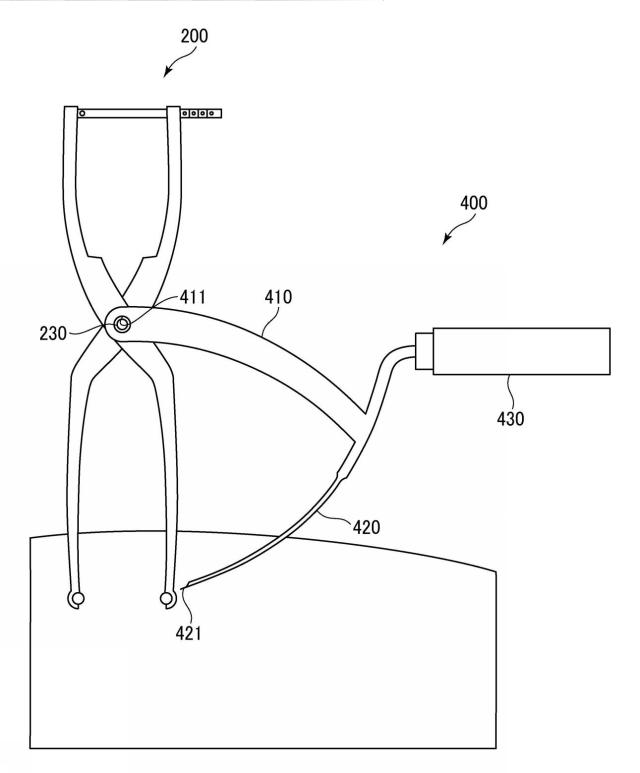 WO2017141459-トランスバース、および手術器具 図000010