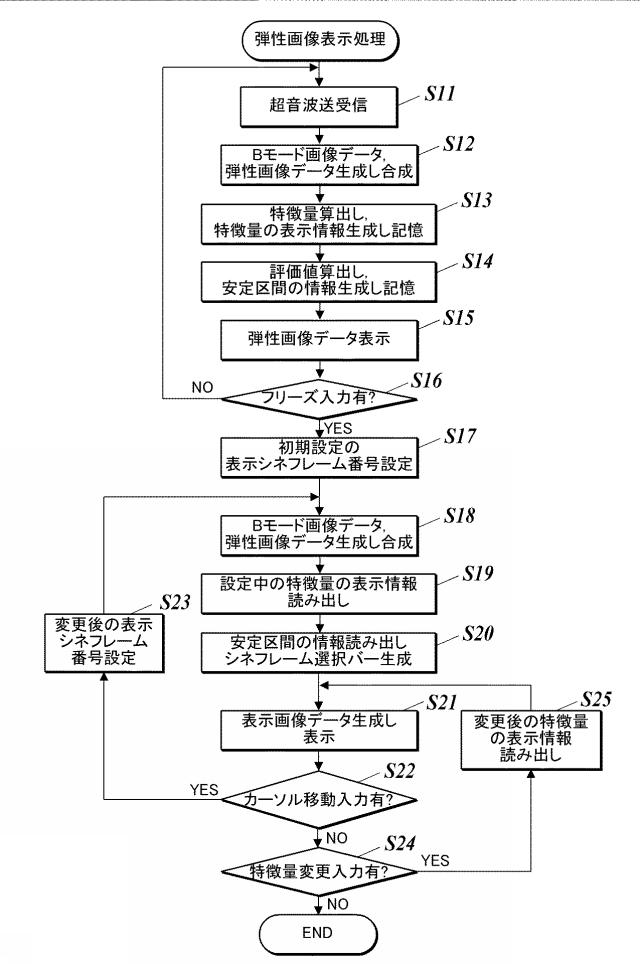 WO2017150355-超音波診断装置及び超音波情報処理方法 図000011