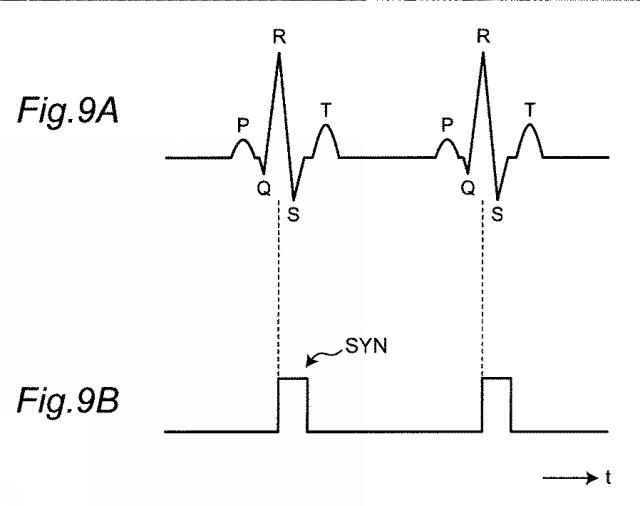 WO2020008864-心電計測システムおよび心電送信機 図000011