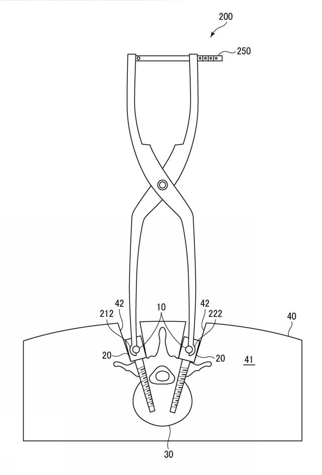 WO2017141459-トランスバース、および手術器具 図000014