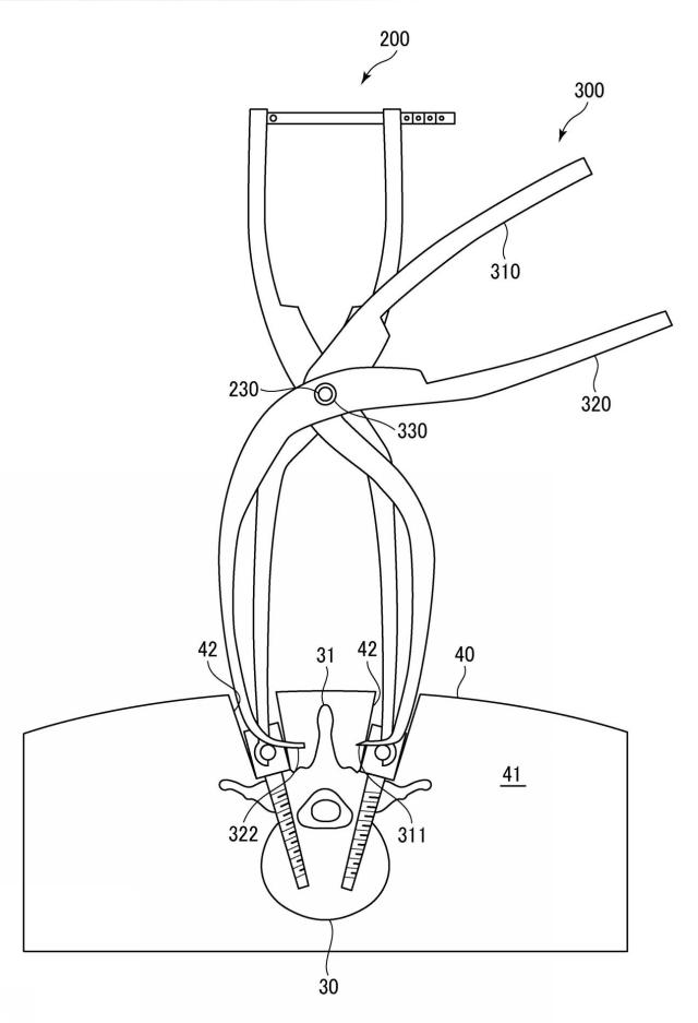 WO2017141459-トランスバース、および手術器具 図000015